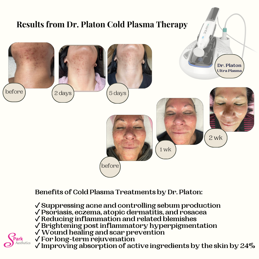 Dr. Platon Cold Plasma Device ( FOR PROFESSIONAL USE ONLY) for promotional pricing, please send me an email.